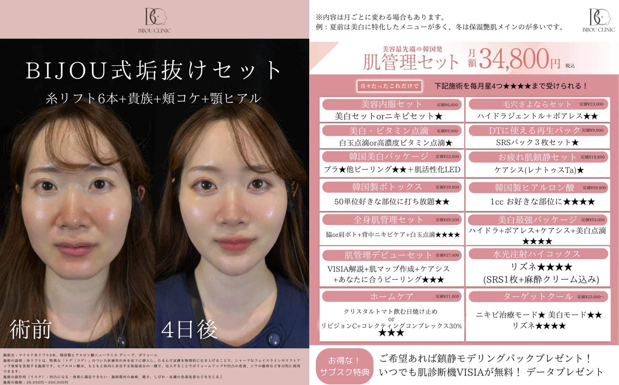 BIJOU CLINICキャンペーン